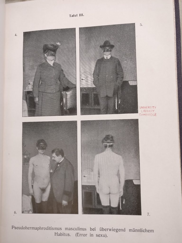 Four photographs of Friederike S., in female and male clothes and unclothed. Friederike is wearing a mask to retain a degree of privacy.